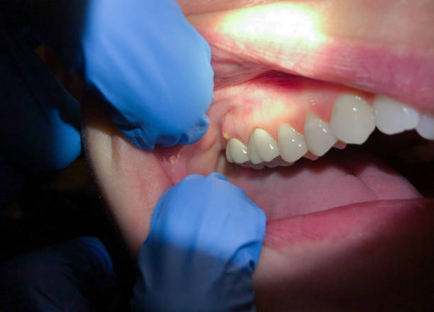 Best Emergency Treatment for Jaw Pain or Injury in Charlestown, MD